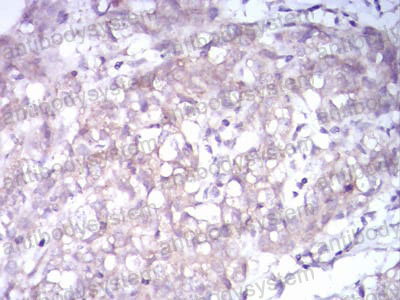 Anti-TrkB /NTRK2 Antibody (R3U42)