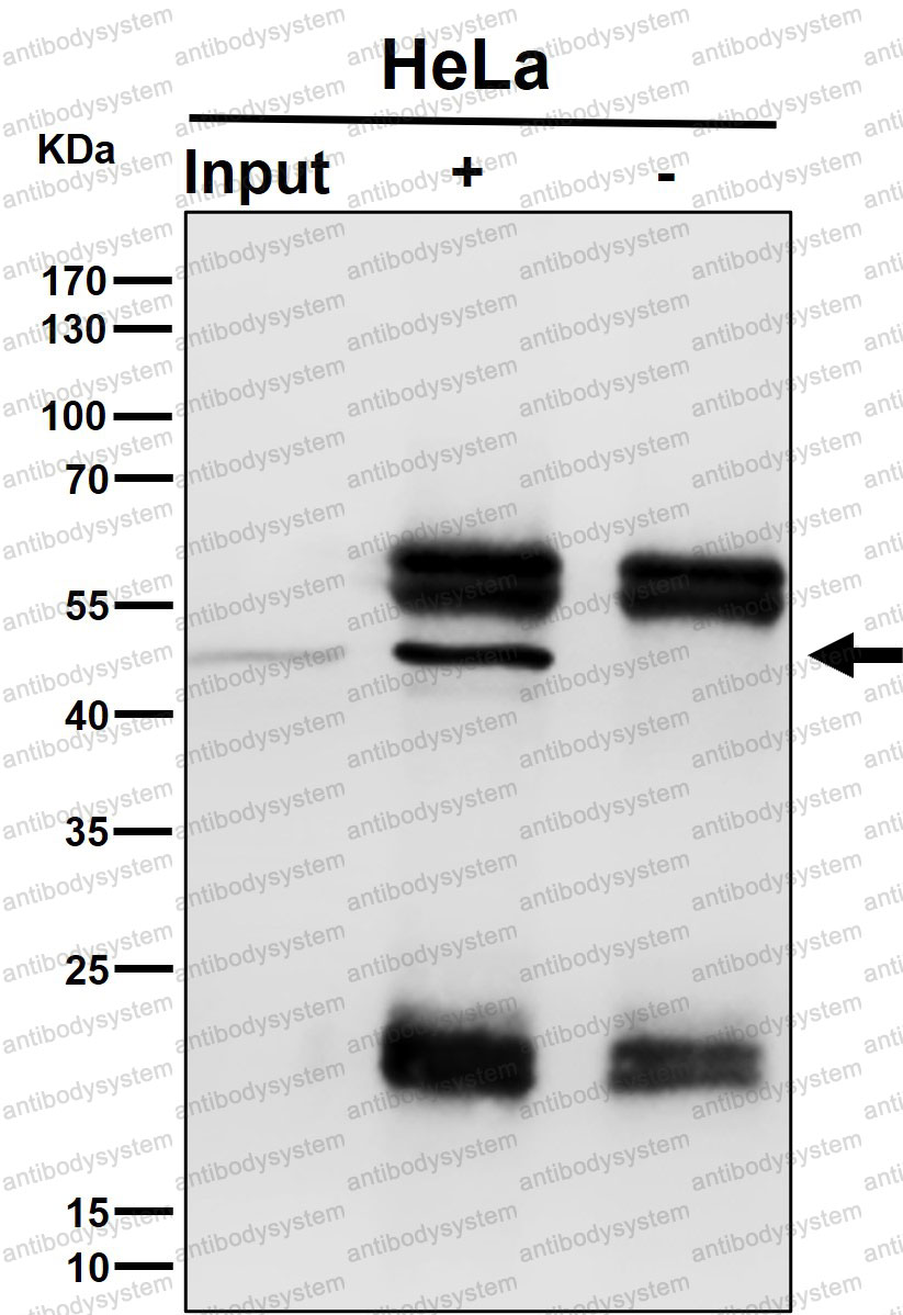 Anti-NFE2 Antibody (R2H23)