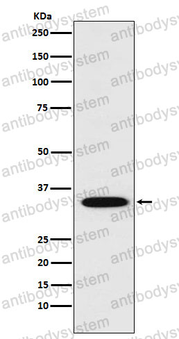 Anti-STX1A Antibody (R2H24)