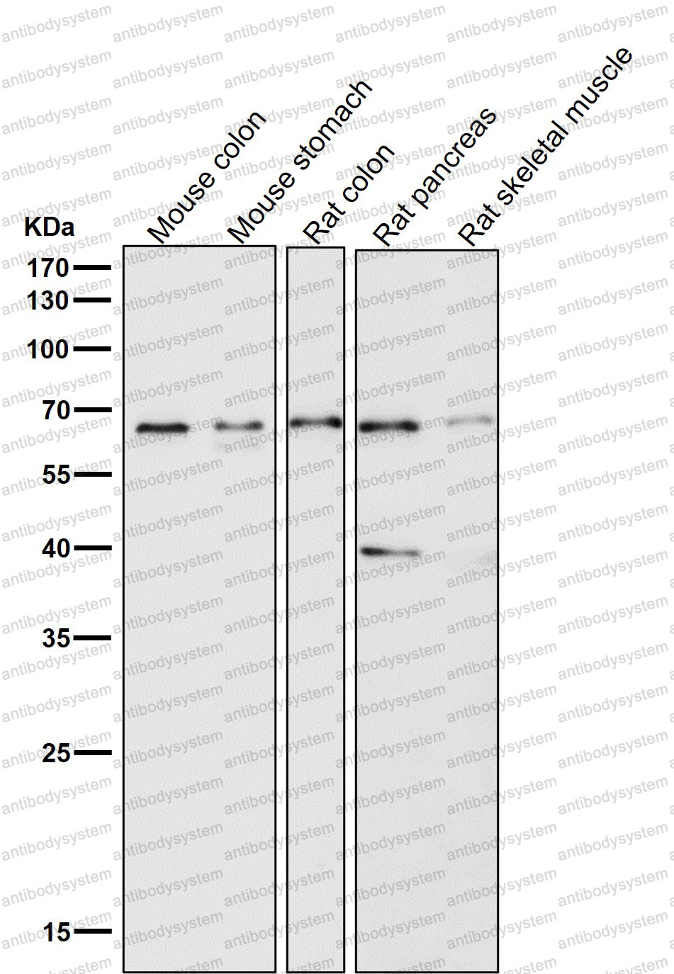 Anti-OCLN Antibody (R2H25)