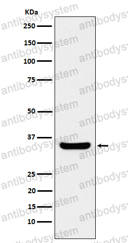 Anti-POU2AF1 Antibody (R2H28)