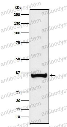 Anti-POU2AF1 Antibody (R2H27)