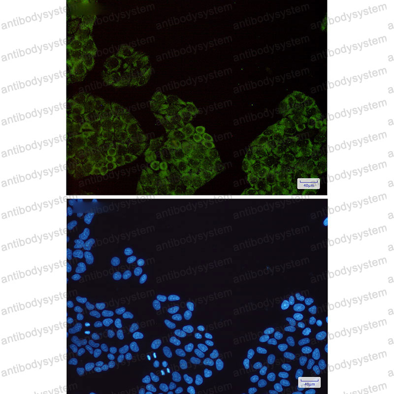 Anti-SMN1 Antibody (R2H30)