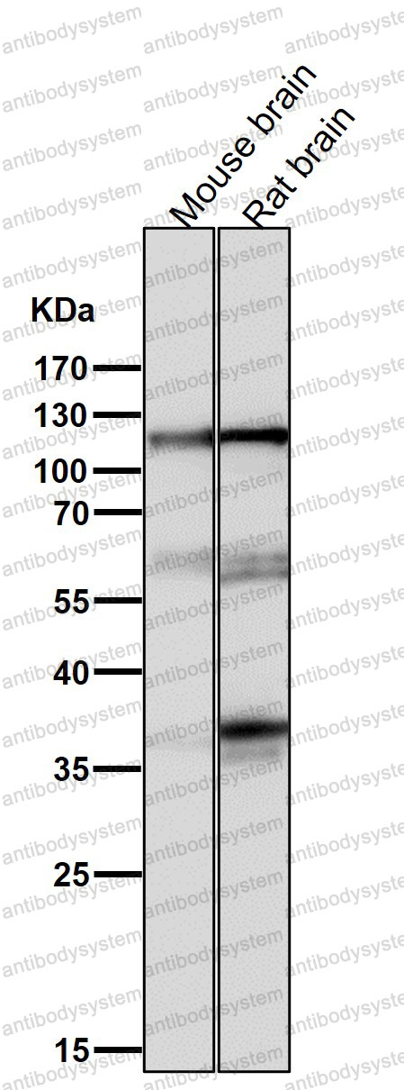 Anti-Drebrin 1/DBN1 Antibody (R2H31)