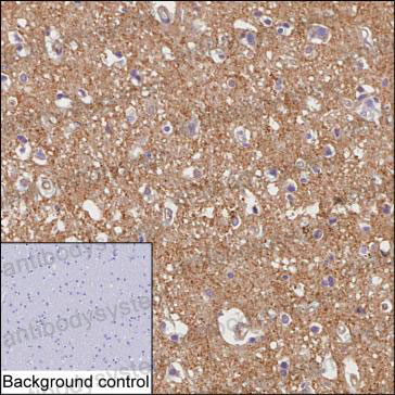 Anti-Drebrin 1/DBN1 Antibody (R3U45)