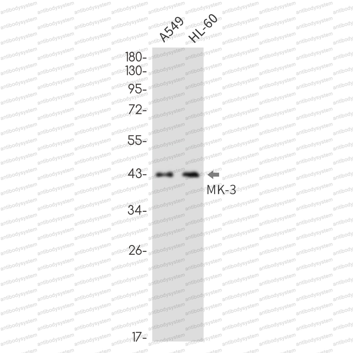 Anti-MAPKAPK3 Antibody (R2H33)