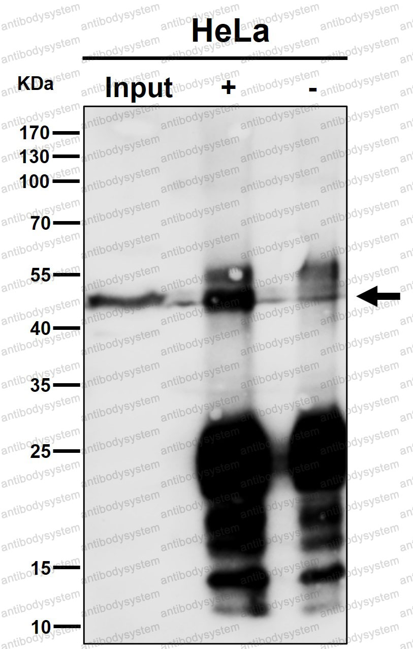 Anti-MAPKAPK3 Antibody (R2H32)