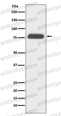 Anti-TBR1 Antibody (R2H34)
