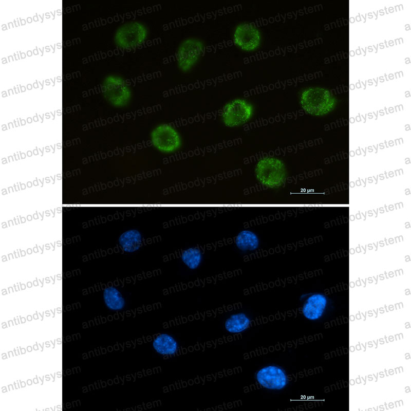 Anti-MOG Antibody (R2H37)