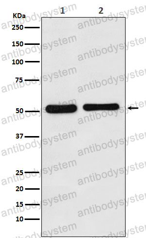 Anti-FSCN1 Antibody (R2H41)