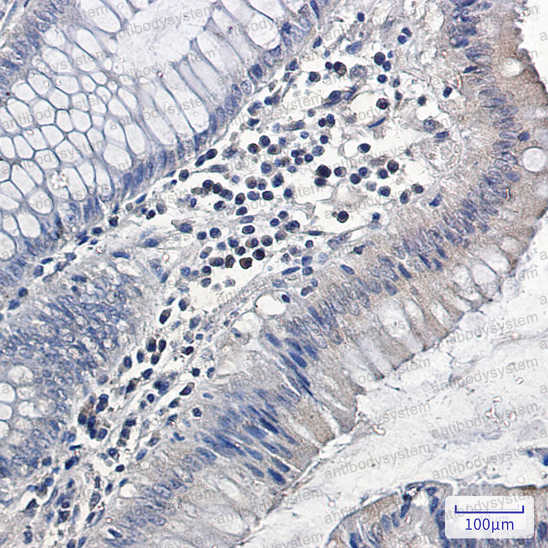 Anti-MAPK6 Antibody (R2H42)