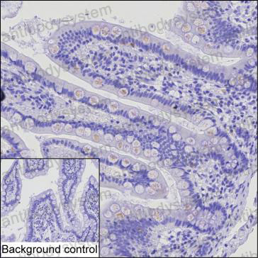 Anti-CCL15/HCC-2/LKN-1/MIP-5 Antibody (R3U49)