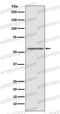 Anti-AMHR2/MISRII Antibody (R2H43)