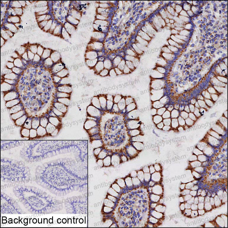Anti-CLPP Antibody (R3U53)