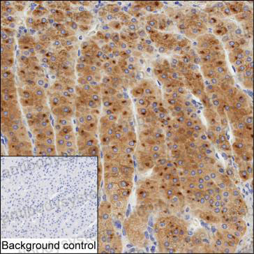 Anti-QPCT Antibody (R3U54)