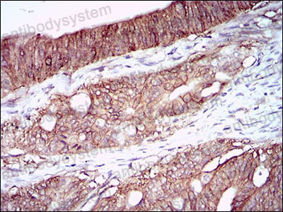 Anti-CA9 Antibody (R3U58)