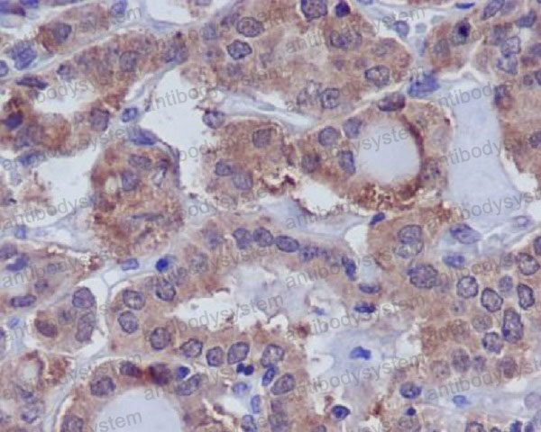 Anti-DUSP6 Antibody (R1B64)