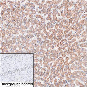 Anti-HADH Antibody (R3U62)
