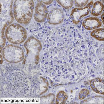 Anti-IMMT Antibody (R3U63)