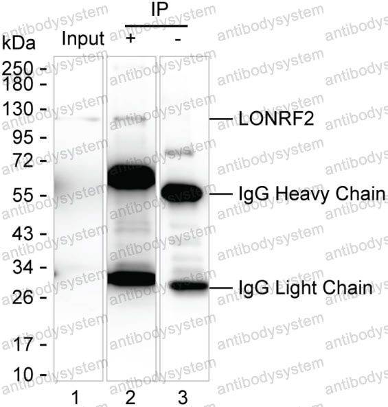 Anti-LONRF2 Antibody (R3U65)
