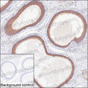 Anti-LONRF2 Antibody (R3U64)