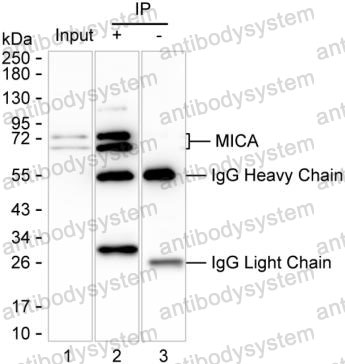 Anti-MICA Antibody (R3U68)