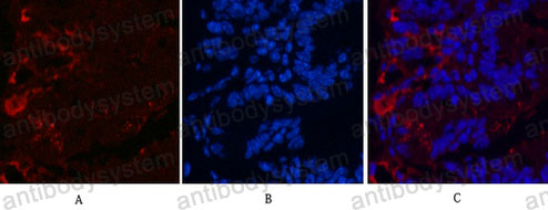 Anti-KIF7 Antibody (R3U69)
