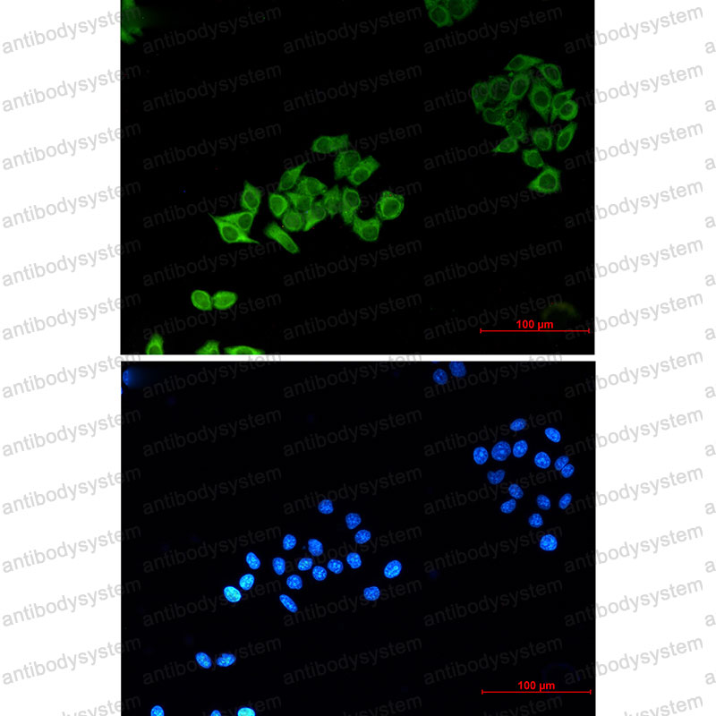 Anti-ABCB5 Antibody (R3U71)