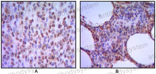 Anti-PWWP3A/MUM1 Antibody (R3U73)
