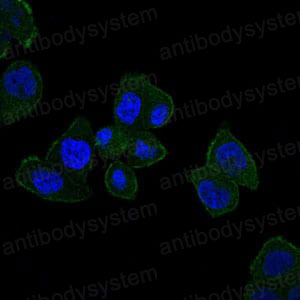Anti-HFE Antibody (R3U76)