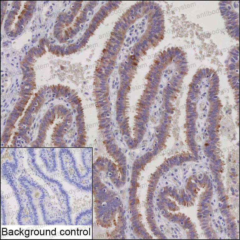 Anti-MINDY4 Antibody (R3U80)
