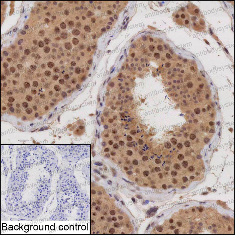 Anti-ARID4B Antibody (R3U81)