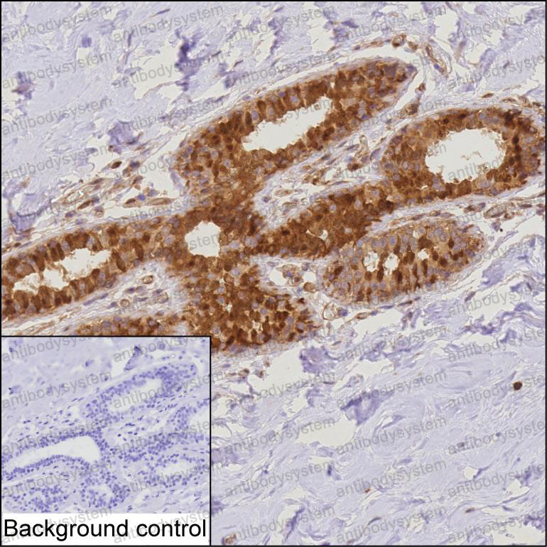 Anti-PDCD4 Antibody (R3U84)