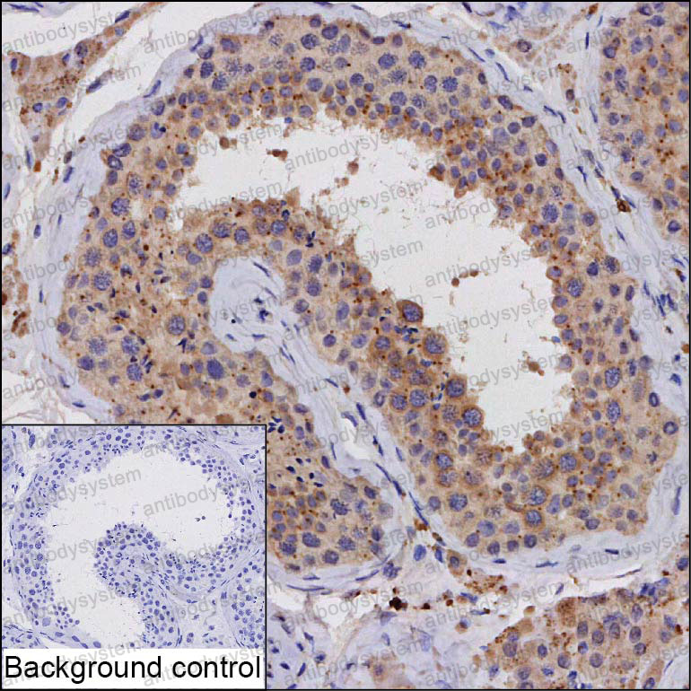 Anti-CEP55 Antibody (R3U86)