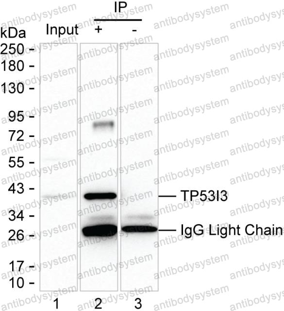 Anti-TP53I3 Antibody (R3U88)
