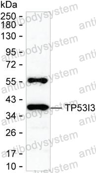 Anti-TP53I3 Antibody (R3U87)