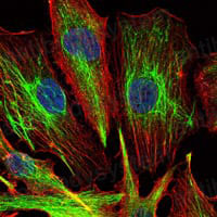 Anti-KLHL22 Antibody (R3U90)