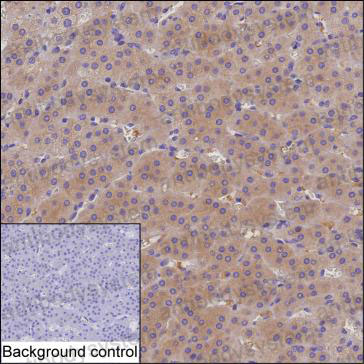 Anti-CMPK2 Antibody (R3U91)