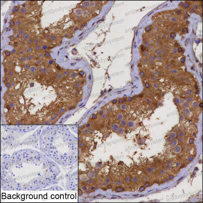 Anti-CDw12/WDR59 Antibody (R3V02)