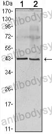 Anti-APOA5 Antibody (R3V03)