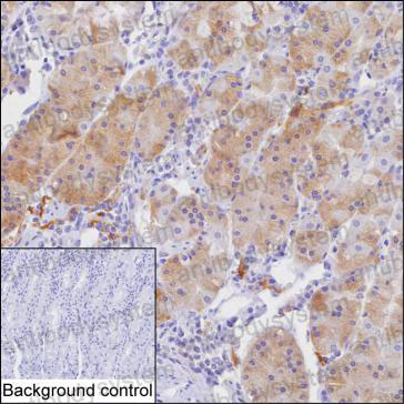 Anti-CXCL17/DMC/VCC1 Antibody (R3V08)