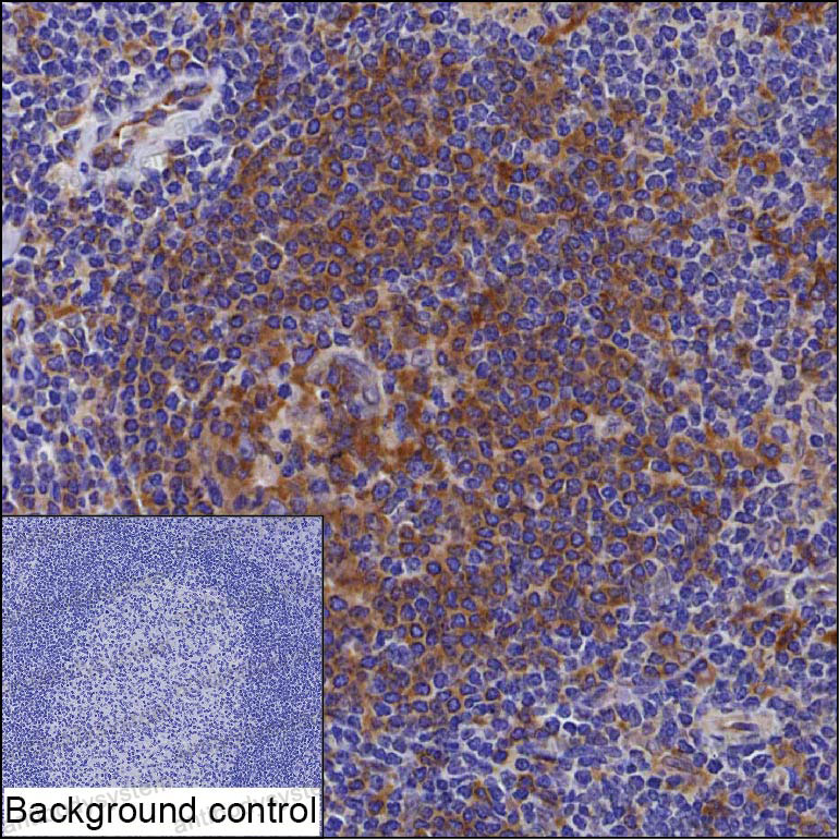 Anti-PIK3AP1 Antibody (R3V13)