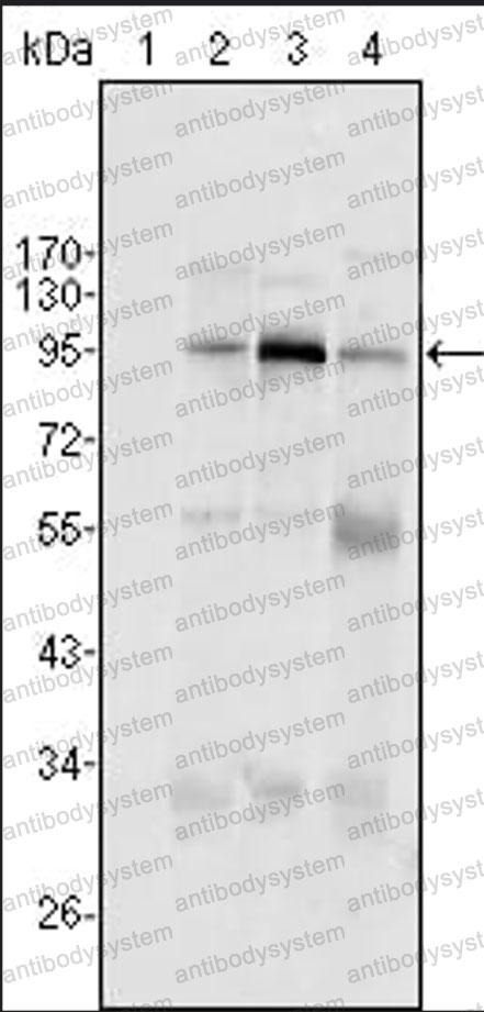 Anti-SND1 Antibody (R3V17)