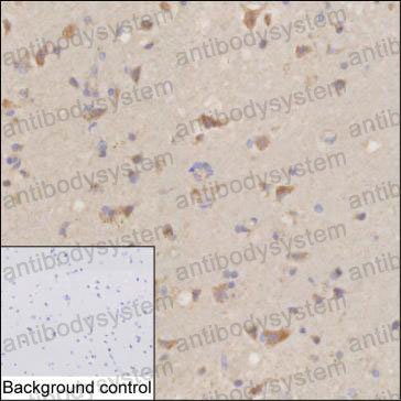Anti-ARC Antibody (R3V18)