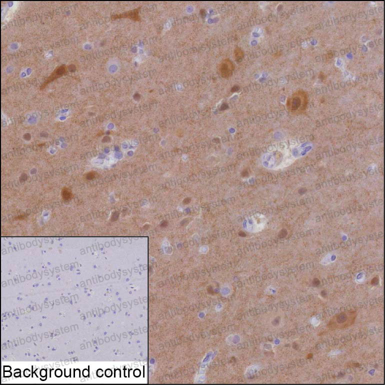 Anti-HOMER1 Antibody (R3V28)