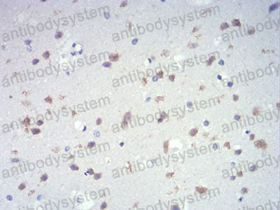 Anti-IL28A/IFNL2 Antibody (R3V32)
