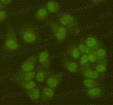 Anti-SIRT6 Antibody (R3V40)