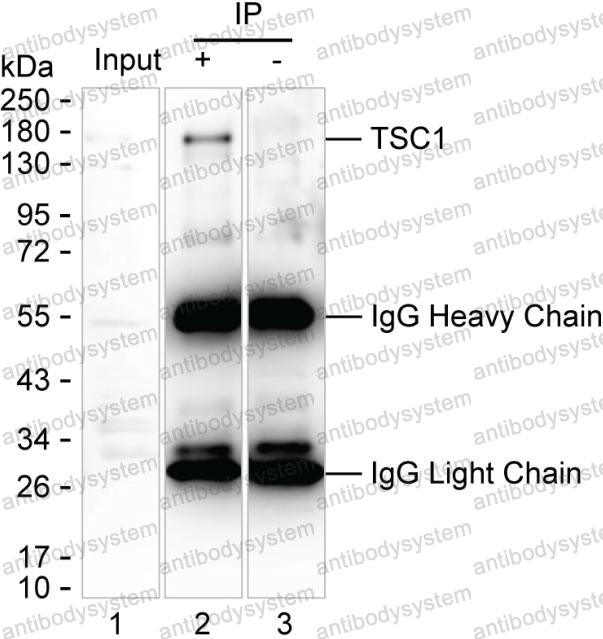 Anti-TSC1 Antibody (R3V57)