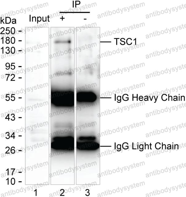 Anti-TSC1 Antibody (R3V56)