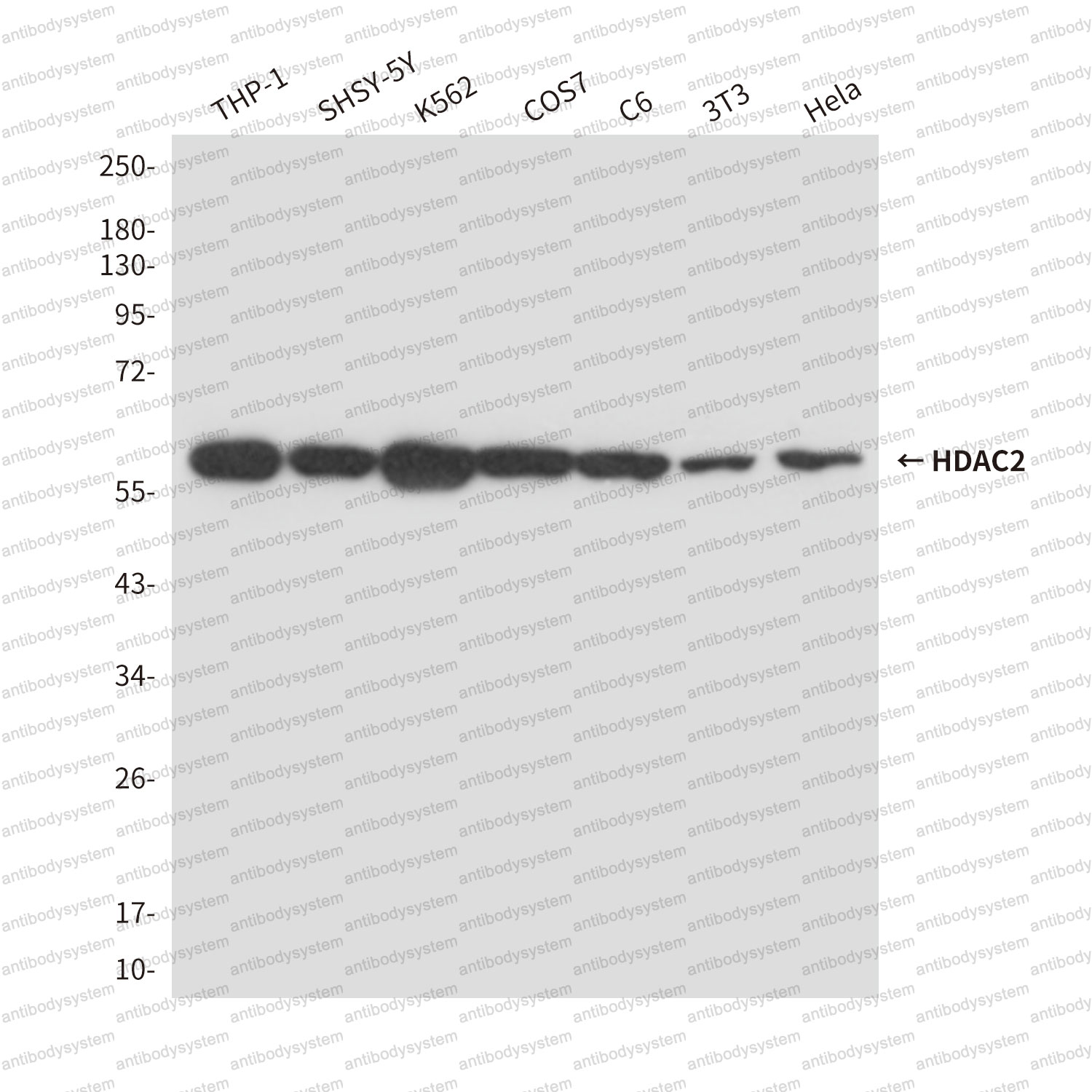 Anti-HDAC2 Antibody (R3V60)